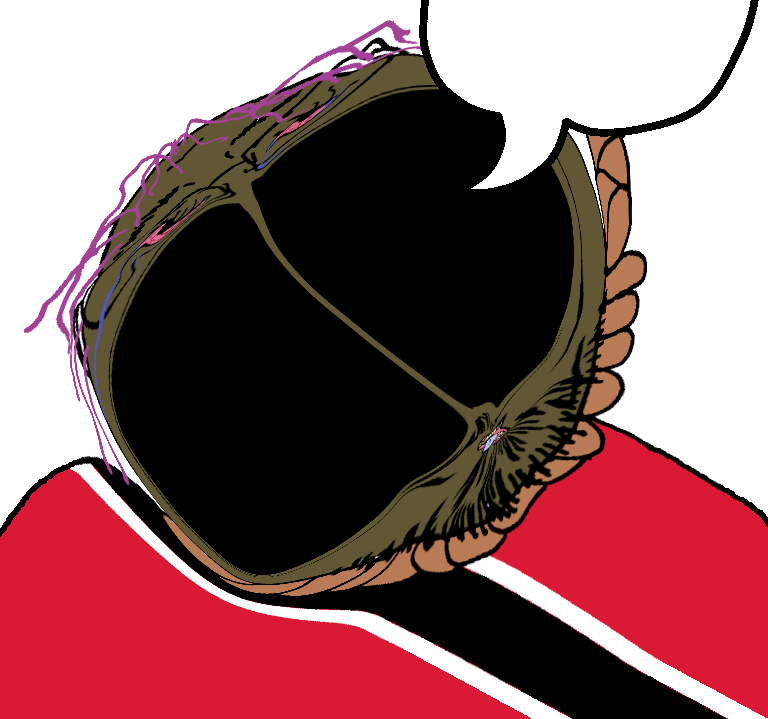 13.png