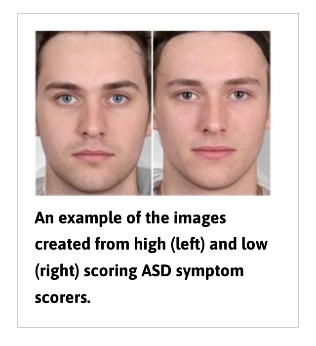 3949334_autismo_vs_nt.jpg