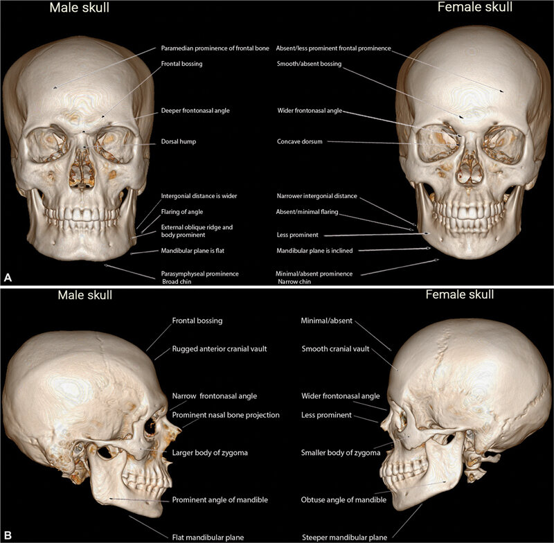 Key-skeletal-differences-in-male-and-female-skulls.jpg