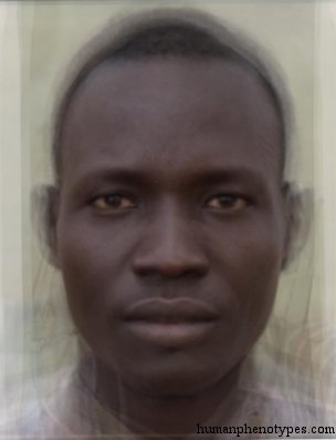 nilotidm.jpg