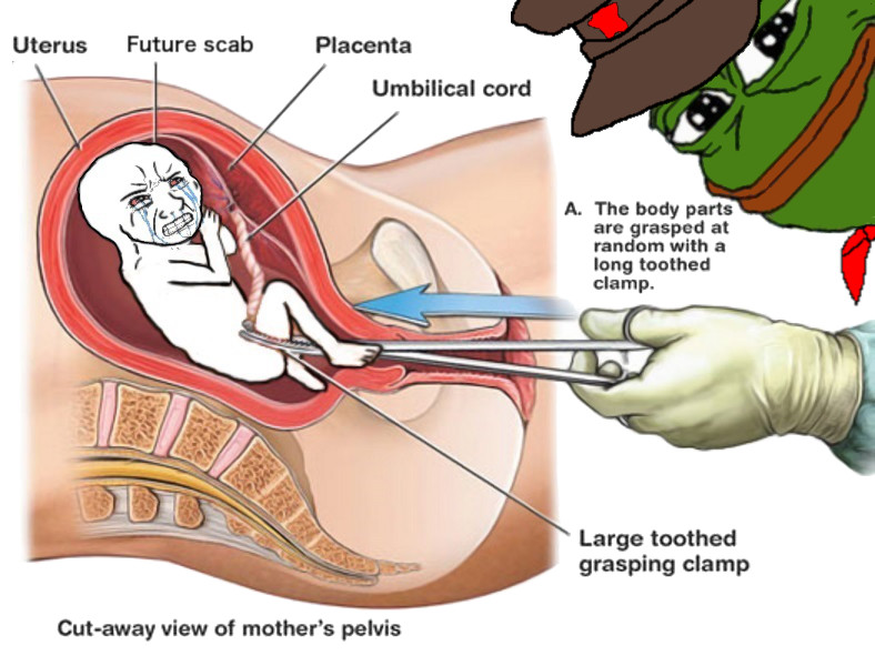 pepe.jpg