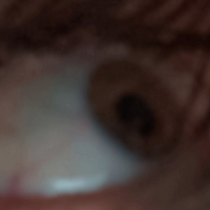 chris eye