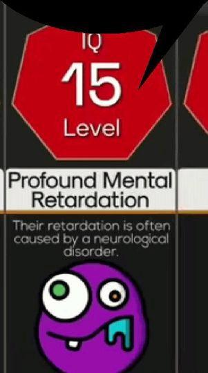 profound mental retardation.