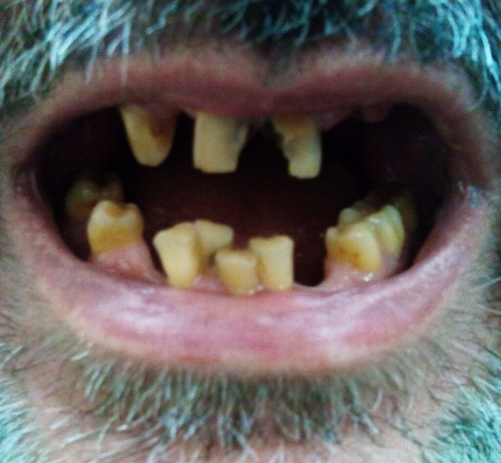 Tired_teeth.jpg